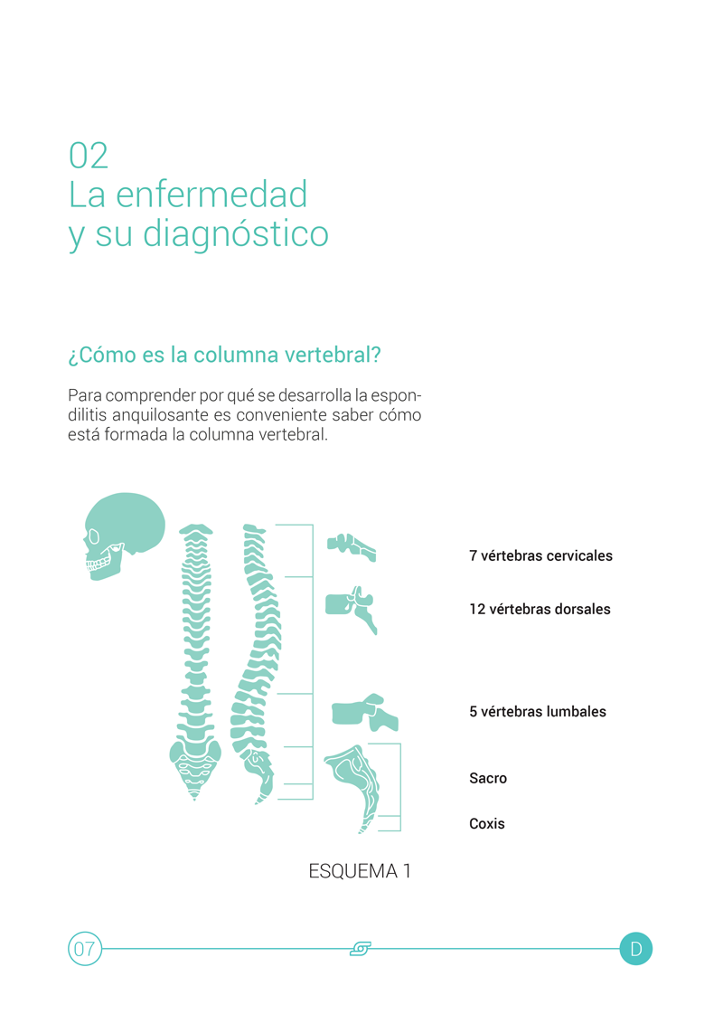 Espondilitis Anquilosante 1